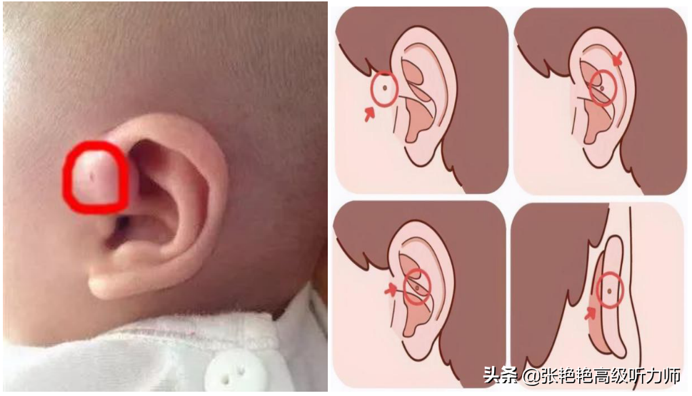 耳垂大小和福气有关吗三种有福的耳朵