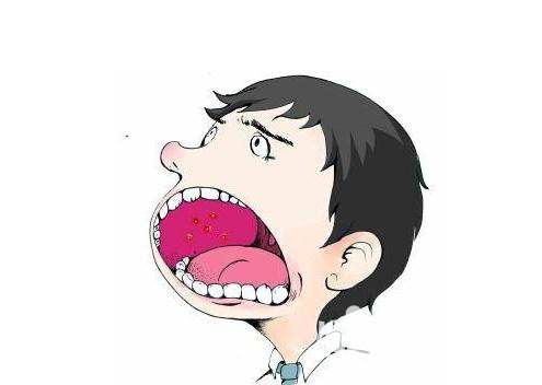 农村俗语“张口疮，裂口疮，都向瓢把讨药方”什么意思，怎么用？