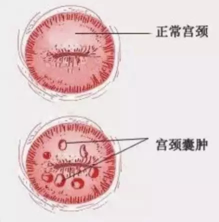 子宫异常出血可以买保险吗(好文收藏 - 得了妇科病,还能买保险吗?