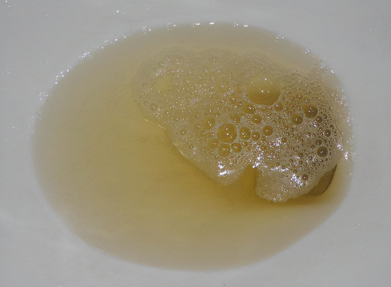 有人一喝水就尿多，有人却两个小时也不上厕所，哪种人身体更好？