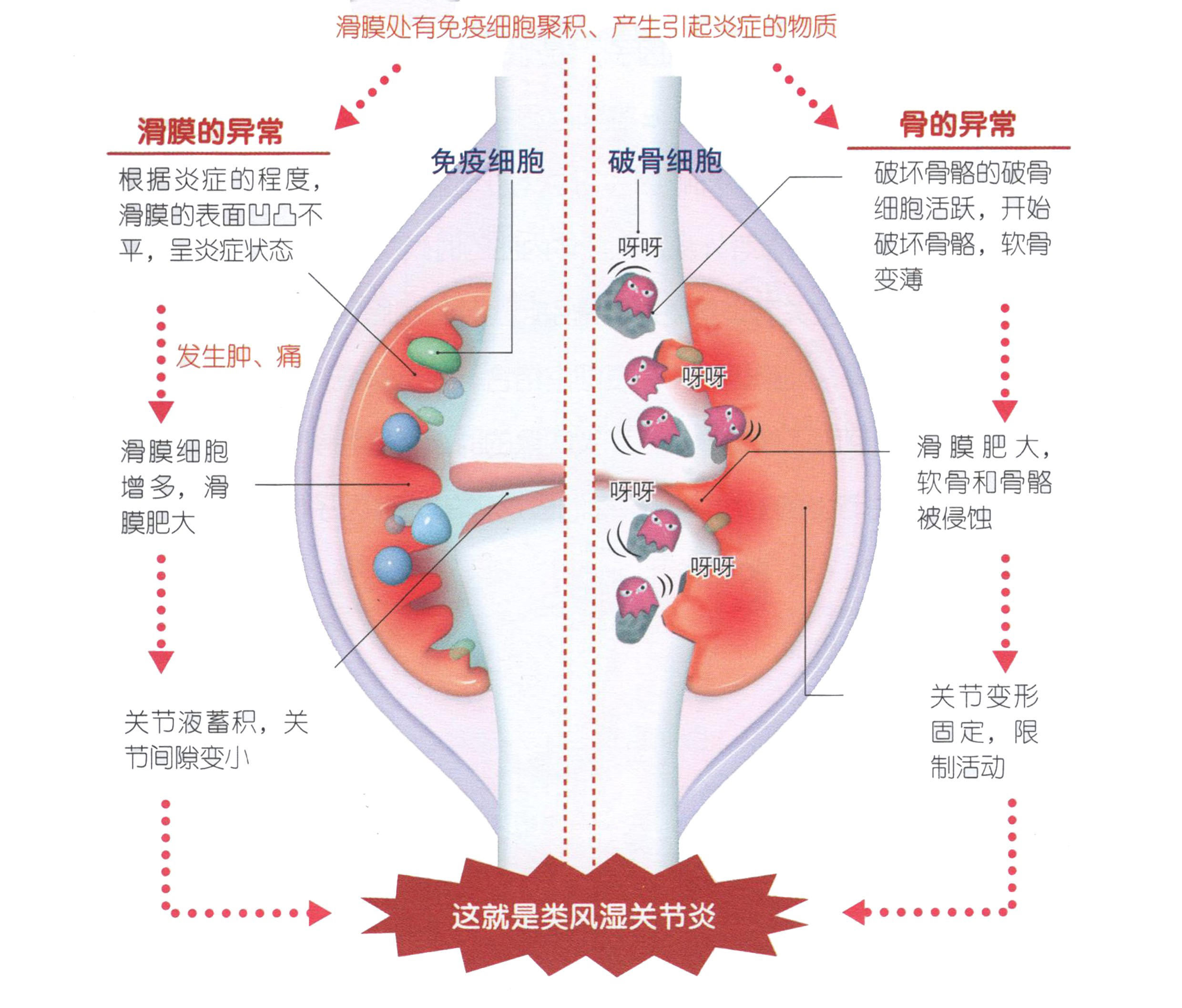 老人膝盖疼是怎么回事（小心6种疾病个个危害巨大）