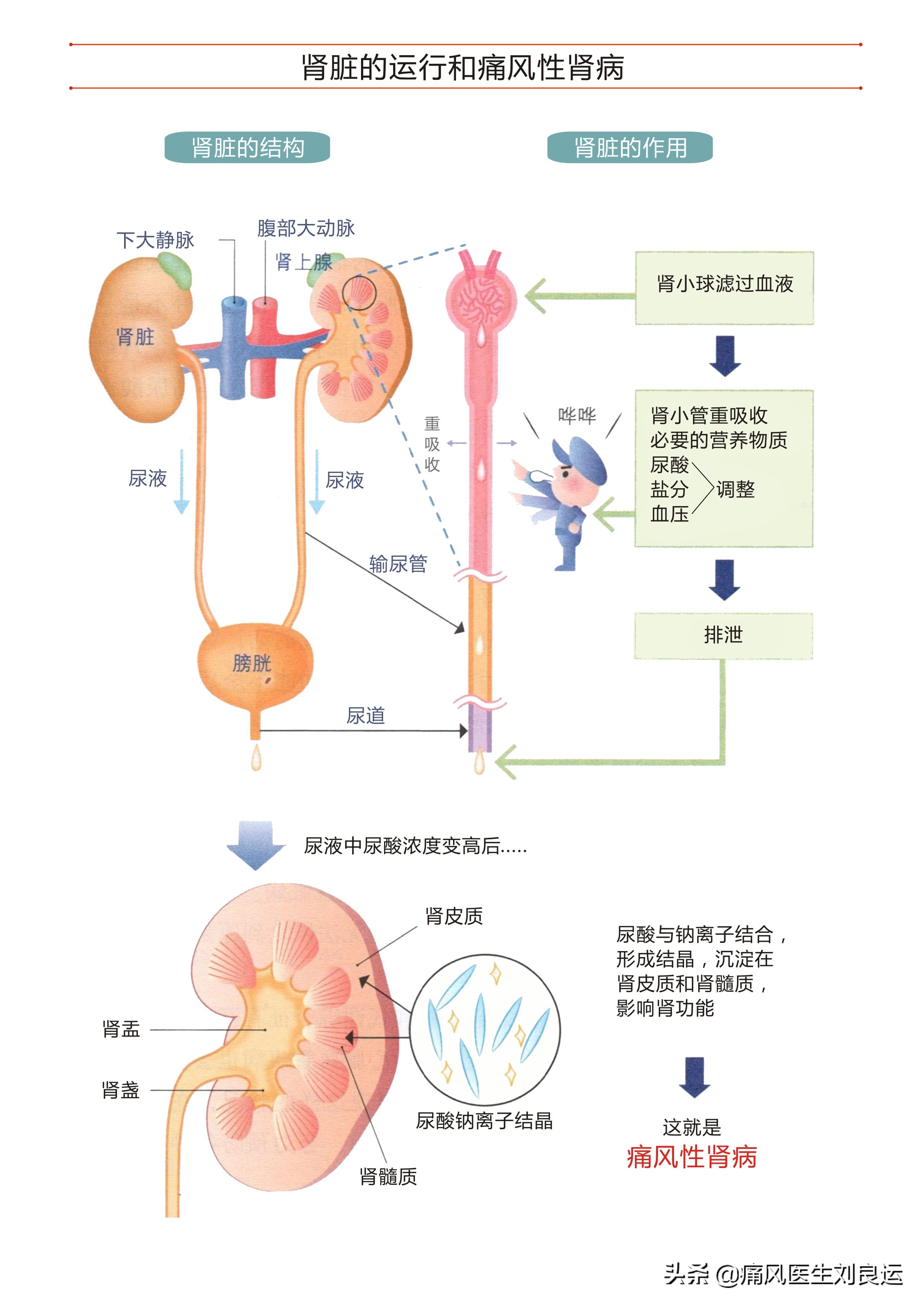 体检尿酸高不一定痛风发作，但你仍需了解血尿酸高的原因和危害