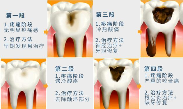 一白遮百丑，口臭毁所有！口臭问题该如何解决？