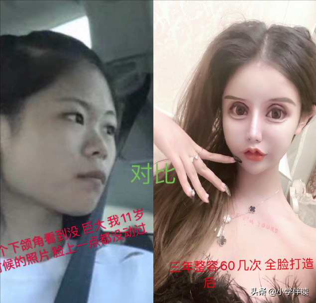 北大不如胸大？暑假整容已接近疯狂，颜值“内卷”不输辅导班