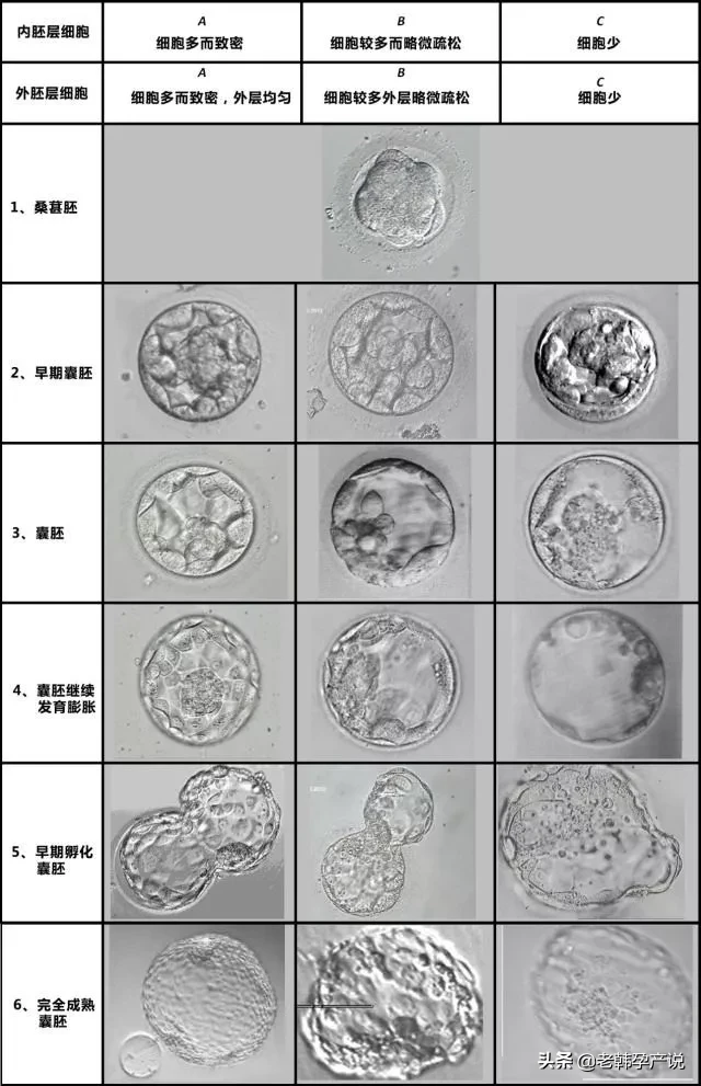 试管婴儿成功率高的医生，这样评估胚胎等级