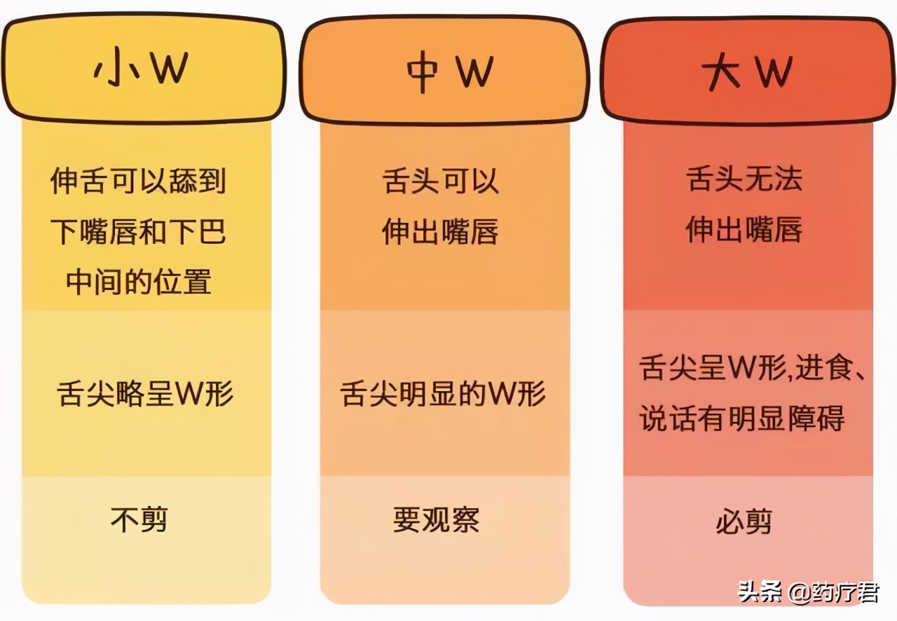 宝宝“舌筋短”，到底要不要剪？最佳处理时间是几岁？