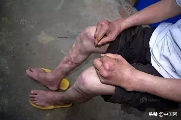 女子因垃圾未分类竟把志愿者掐晕，被行拘3日