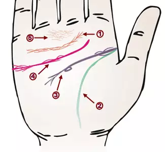 掌纹诊病：可以诊断肝癌、糖尿病、高血压、妇科病、脑溢血