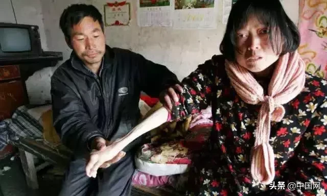 女子因垃圾未分类竟把志愿者掐晕，被行拘3日