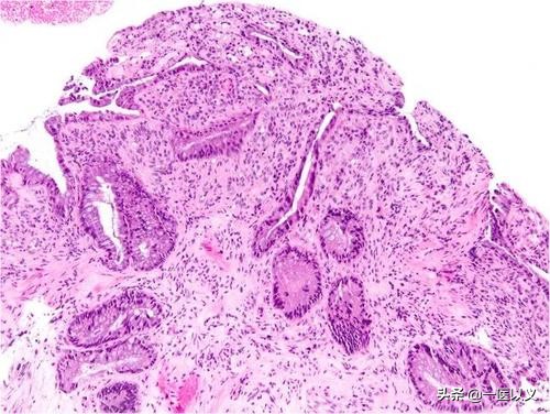 胀气拉肚子怎么办(经常拉肚子、腹胀、腹泻怎么办？医生：3种疾病要早发现早治疗)