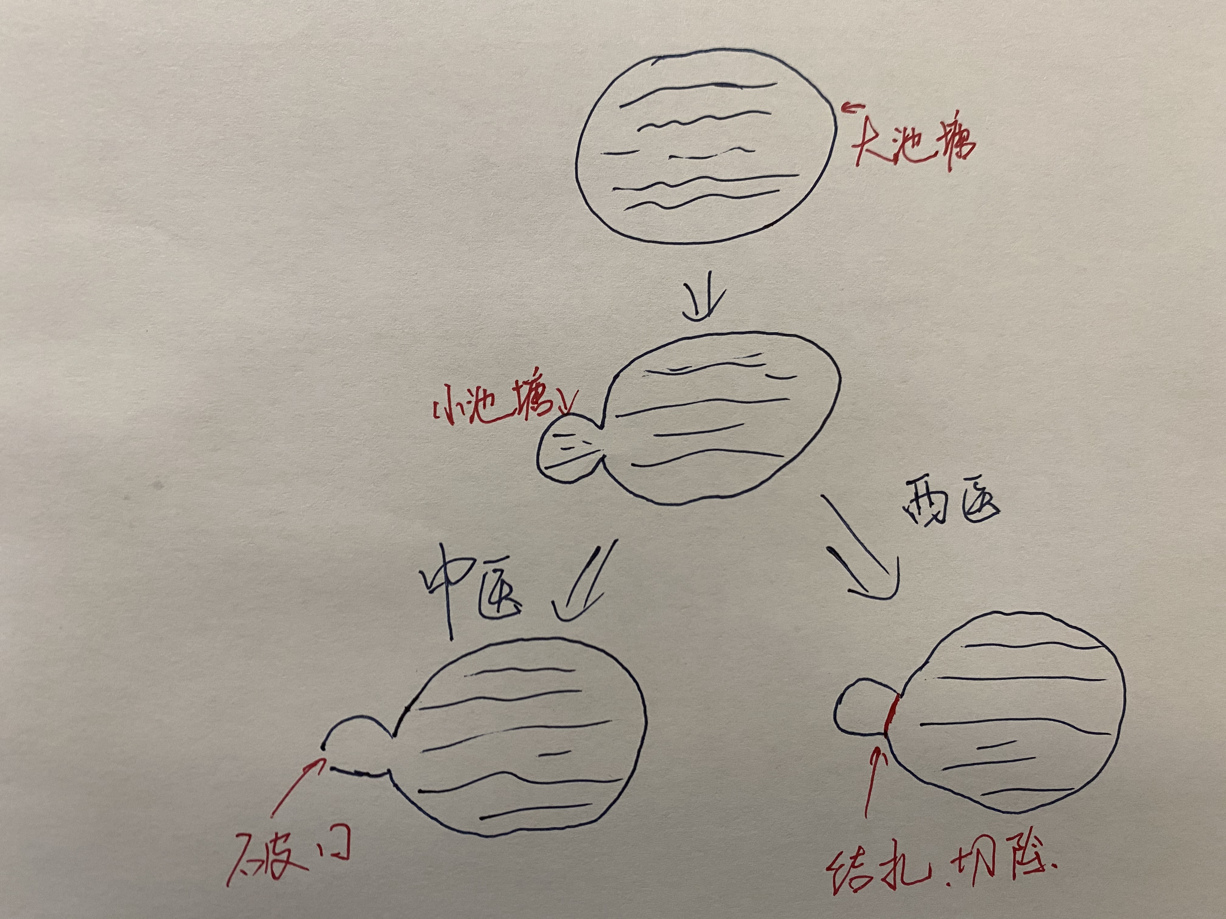 「中西醫之爭」腱鞘囊腫又復發了,是治療方案沒選對