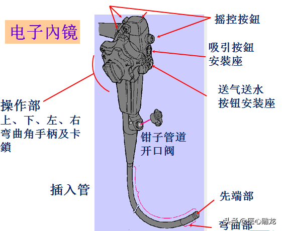 什么是气管镜检查？检查中的感受怎样？看完这篇文章你就知道了