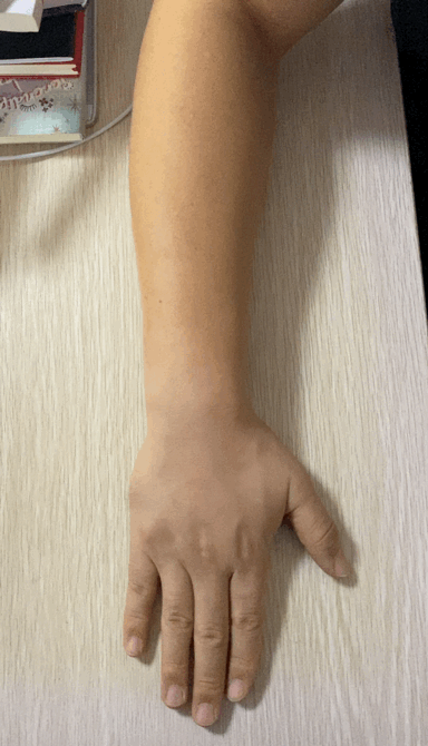 网球肘如何处理(1个动作帮你提前发现"网球肘",4个动作帮你轻松解决它