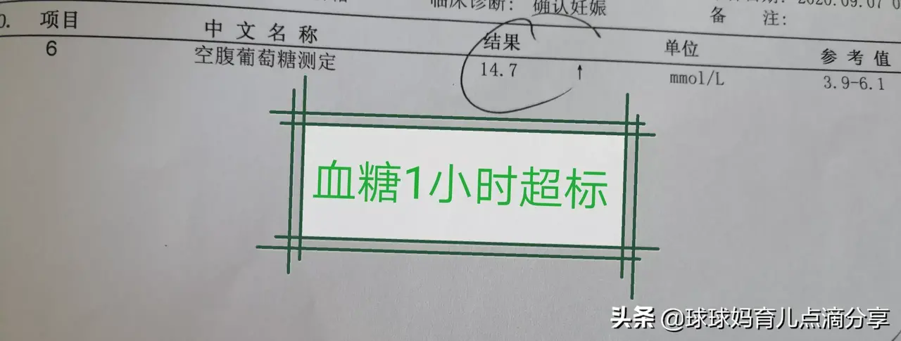 昨天孕期检查糖耐没过，才知道真正控糖是这几方面，以前走入误区