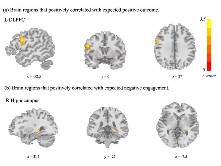 脑科学日报 : 老年效果好？年龄是否影响电休克的抗抑郁疗效？