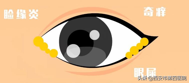 眼睛持续流泪是什么原因？健康中国行动2030关注眼部健康问题