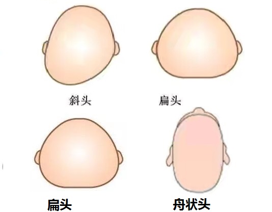 “侧卧，仰卧，俯卧，平躺”，0-1岁宝宝正确睡姿，新手爸妈收藏