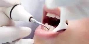 牙龈炎的危害这么大 我们该怎么防治呢？