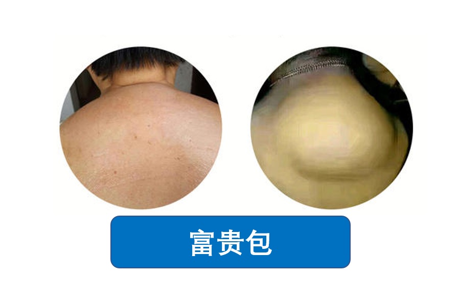 6cd34d3579f94ef195bf83abf6d23408?from=pc