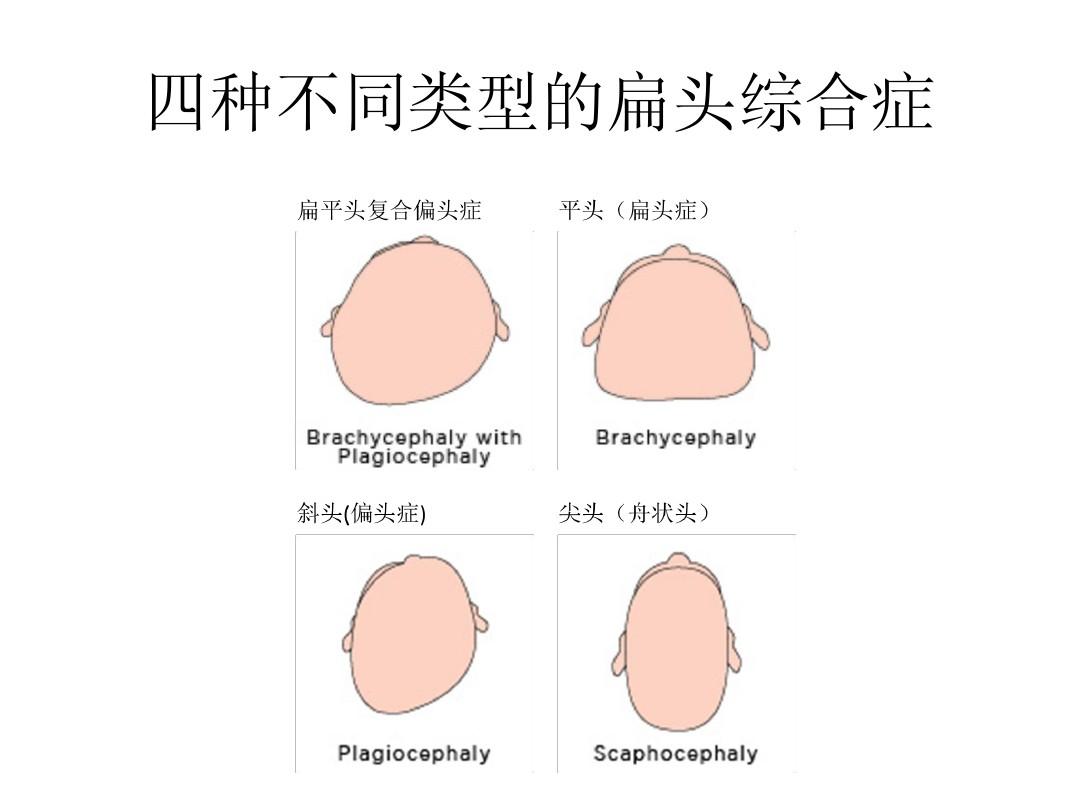 头型影响颜值？如何帮助宝宝睡出完美头型？