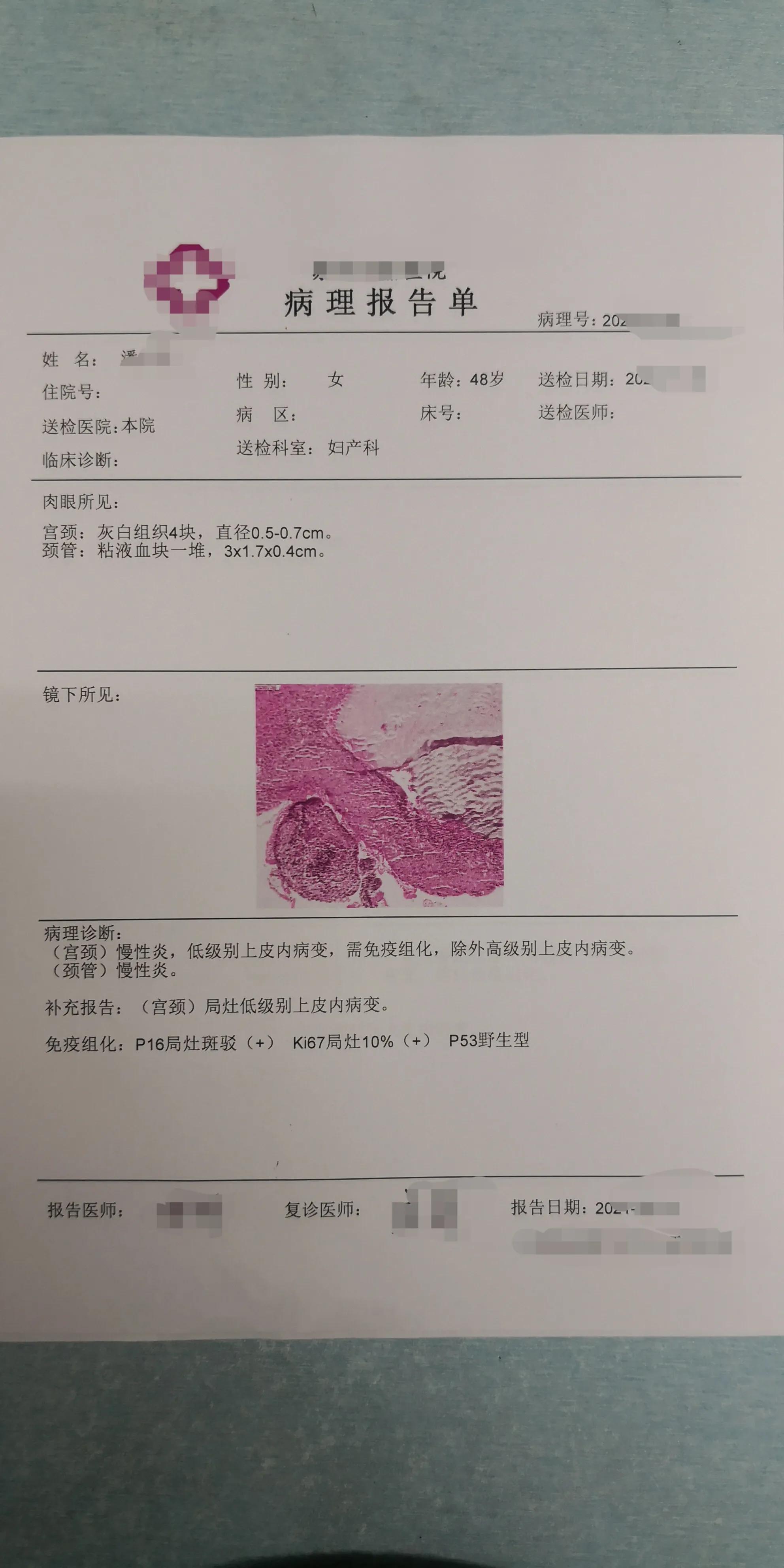 免疫组化检查是什么检查还是治疗及抽血吗