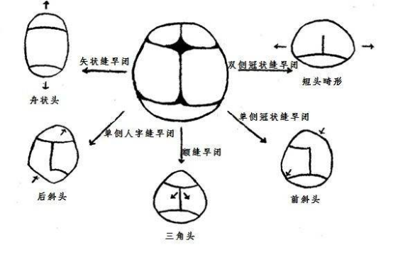 大头娃娃事件后，你的宝宝头大么？