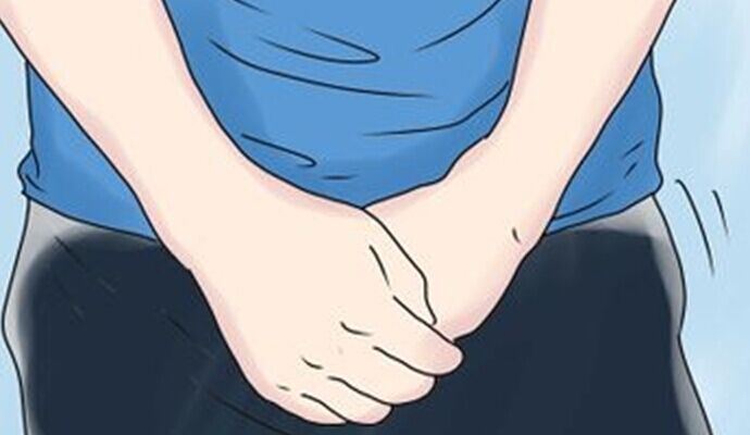 阴囊潮湿是什么原因造成的 精索静脉曲张的症状表现-春风号