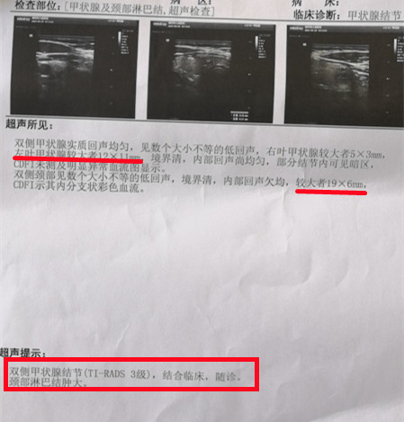 查出甲状腺结节3级，先别急着“动刀”！用中医这个治法才保险