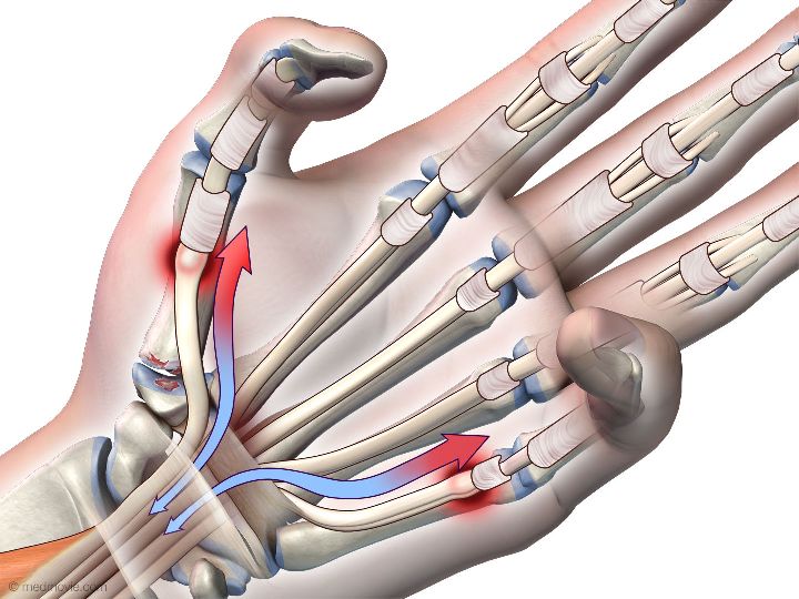 拇指伸肌腱解剖图图片