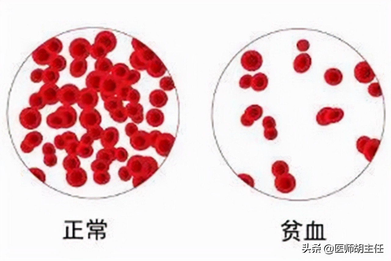 甲钴胺不仅能修复受损神经，还能用于这几种常见病的治疗，好用