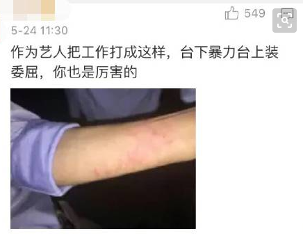 怼韩庚拒杜淳追大张伟，手撕迪士尼的黄小蕾究竟有多疯狂？