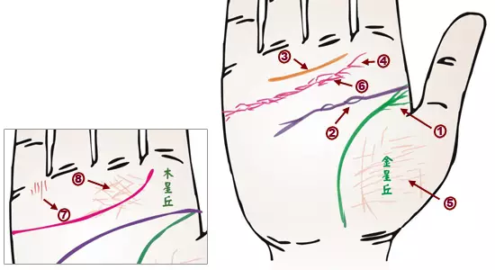 掌纹诊病：可以诊断肝癌、糖尿病、高血压、妇科病、脑溢血