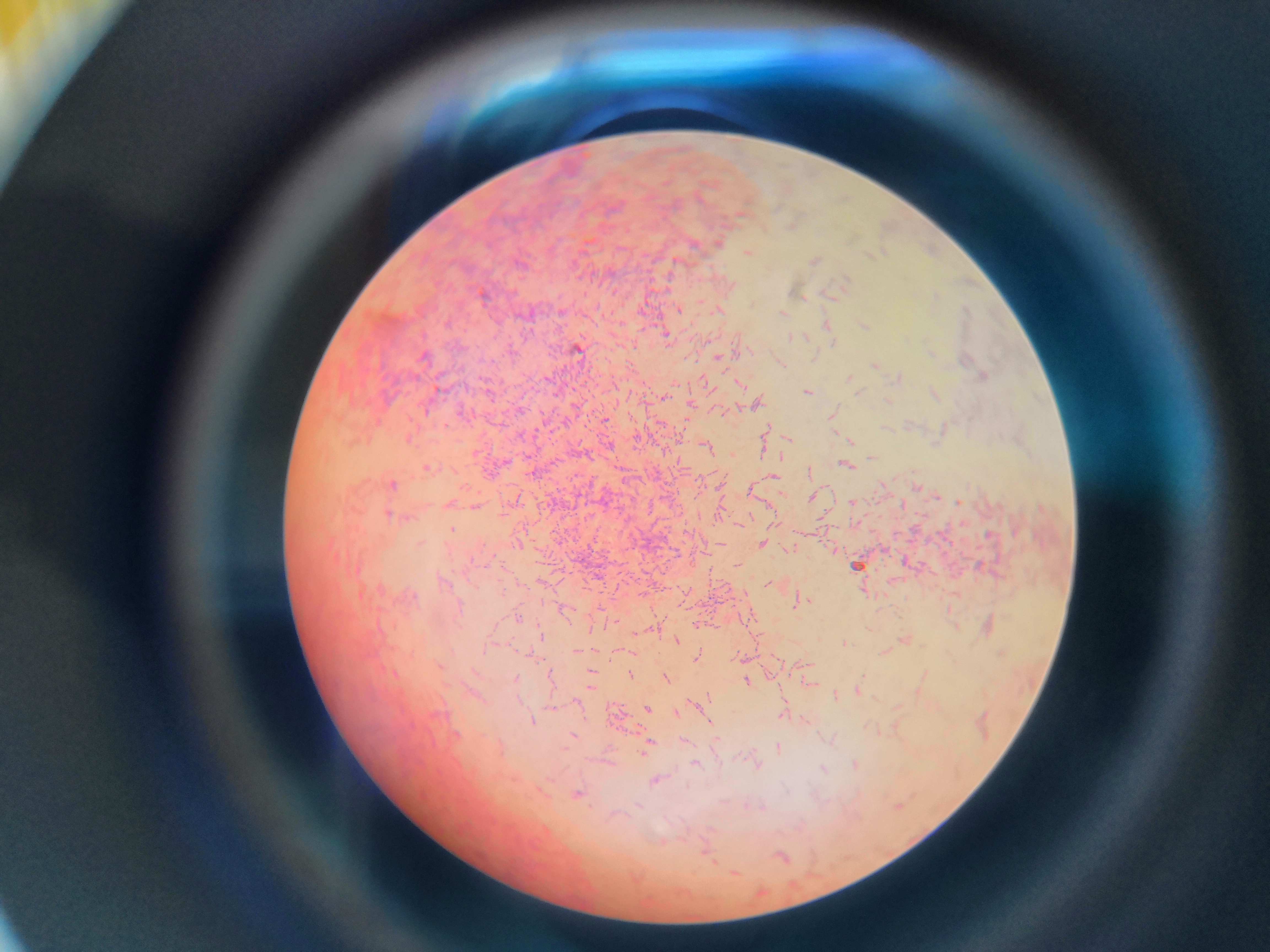 大肠杆菌的革兰氏染色图片