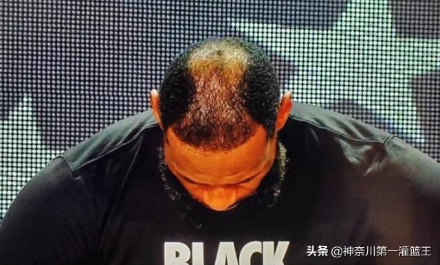 为什么nba球员大多是光头(比普通人都要强壮，为何妖刀、杜兰特和詹姆斯都会早早谢顶？)