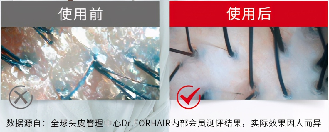 中国发证“认可”，脱发终于有救了