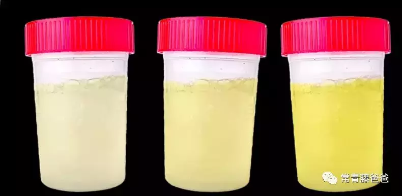 孩子尿这种颜色的尿一定要注意