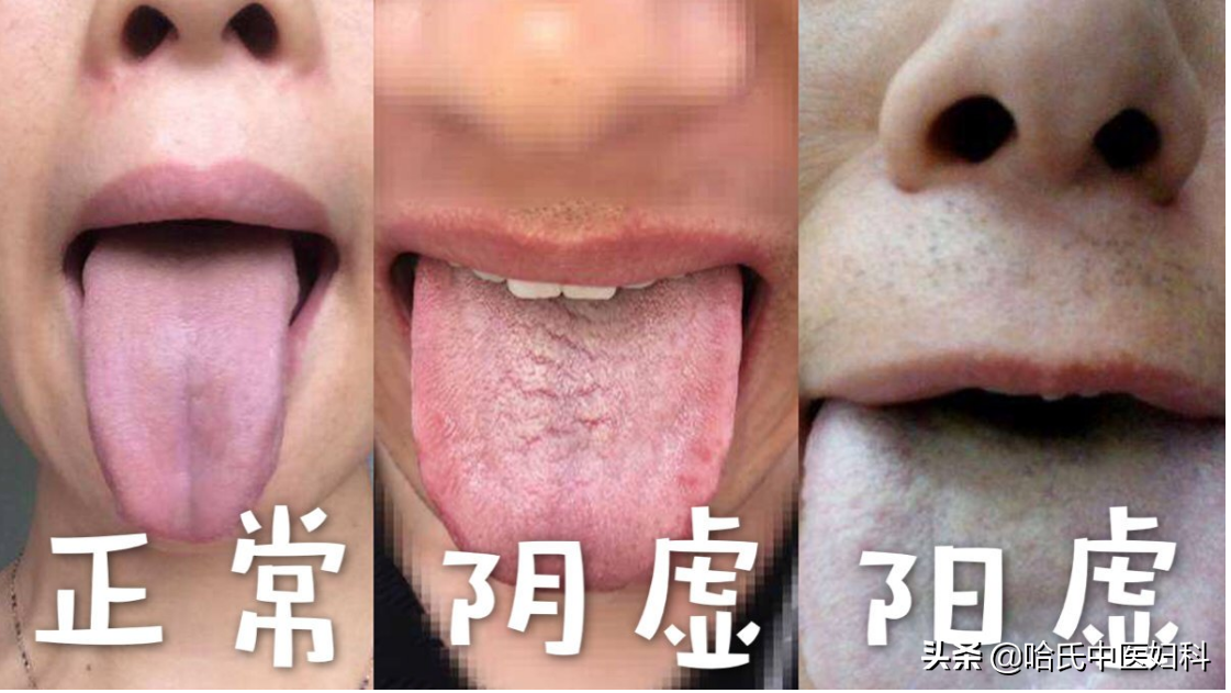 卵泡长不大长得慢？备孕女性这样做，轻松助好孕