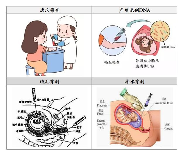 为什么唐氏综合症患者，长相都差不多？该如何预防这种疾病？