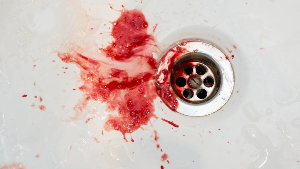 便血鲜红色无疼痛是什么原因(大便出现血样) - 百百科