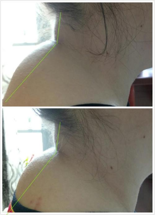 如何消除?医生教您6招