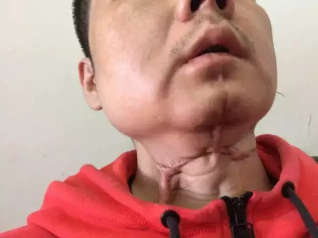 千亿规模的槟榔生意,他们正在把癌症卖给你