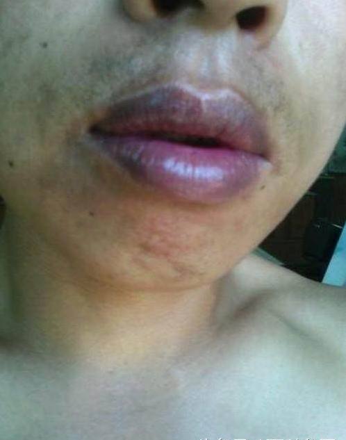 肝不好的人三黑两臭 护肝水果第一名-文化号