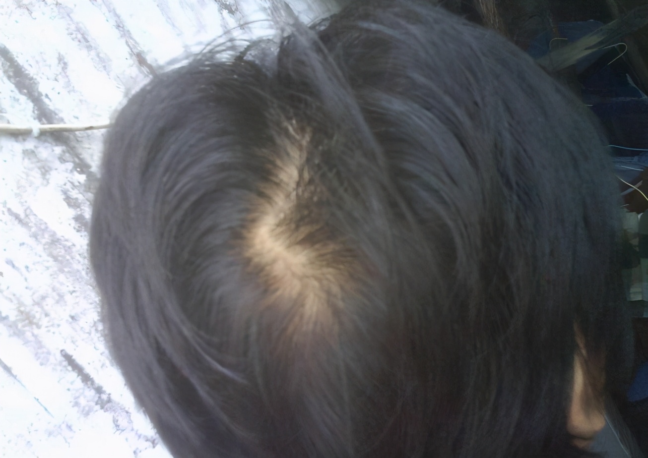 宝宝的头旋,其实是一串神奇密码