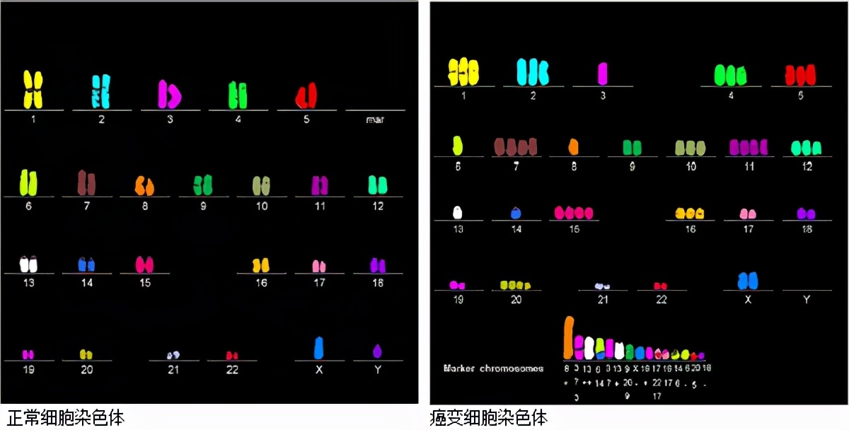 一泡尿就能检测出癌细胞？