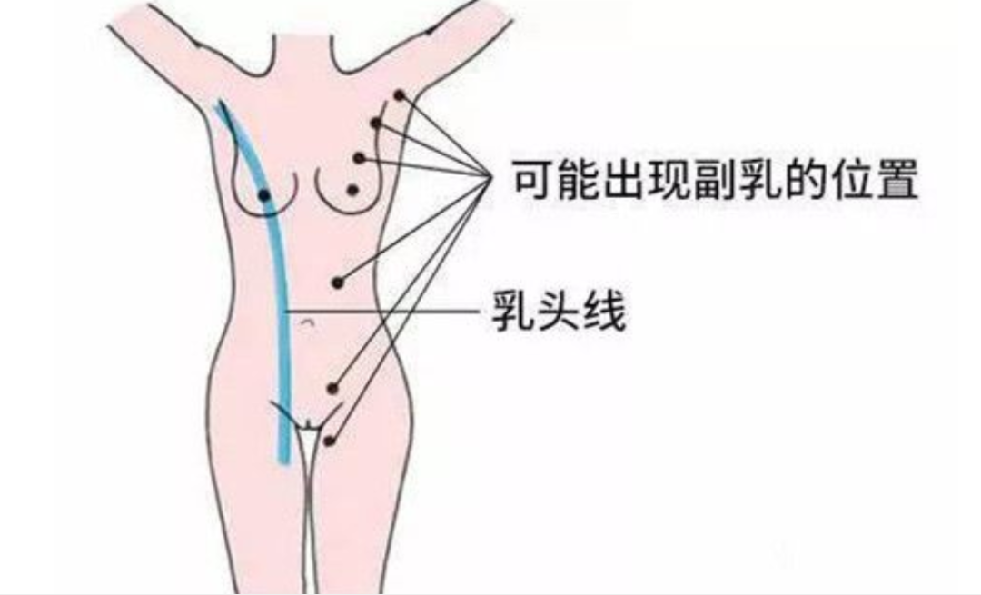 赘肉？副乳？傻傻分不清楚