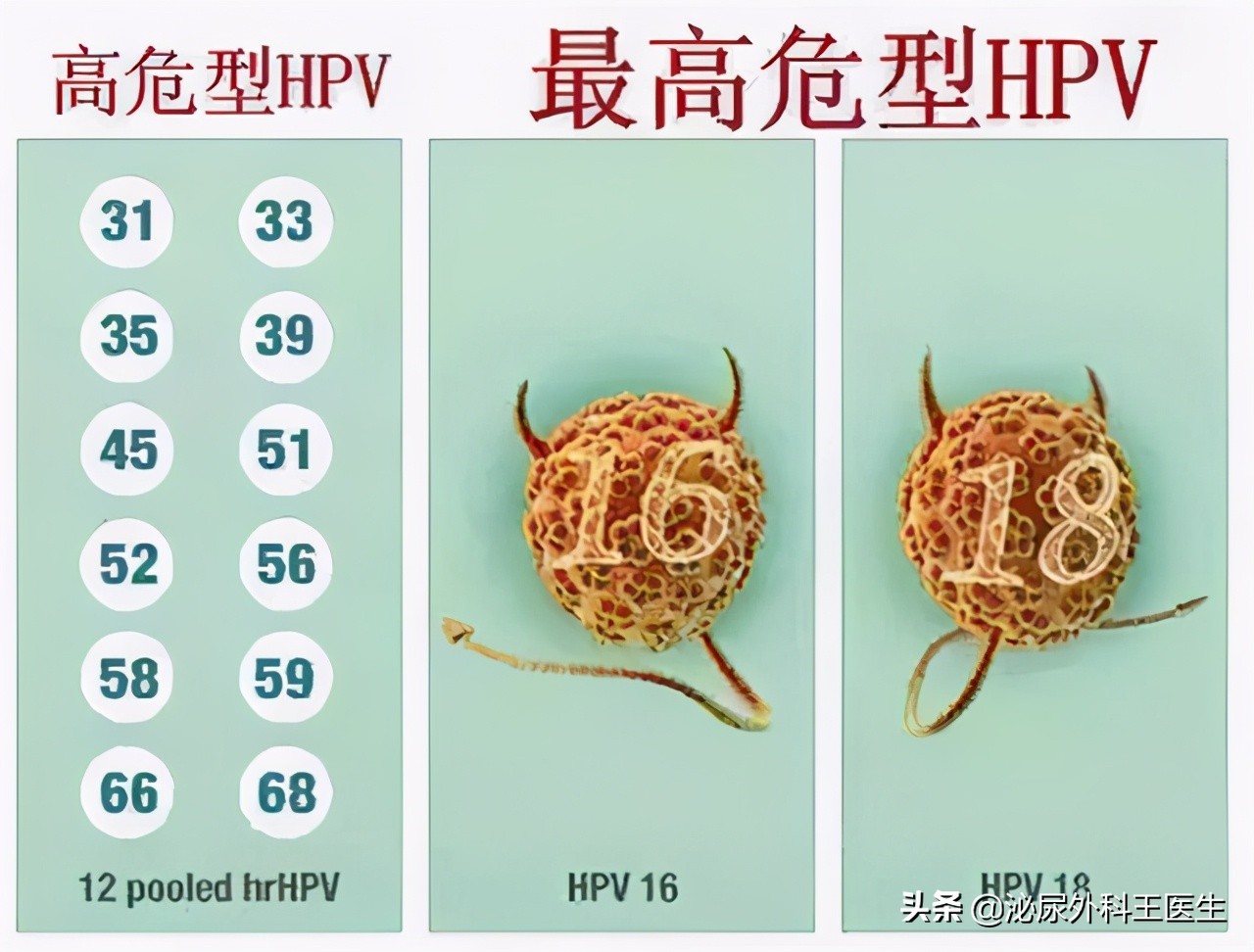"难以启齿"的肛门癌,你了解它吗?出现几个症状,及时就医检查