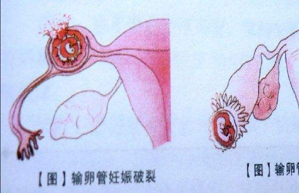 想不通，医生追着问我有没有“性生活”！只是月经不调去看病……