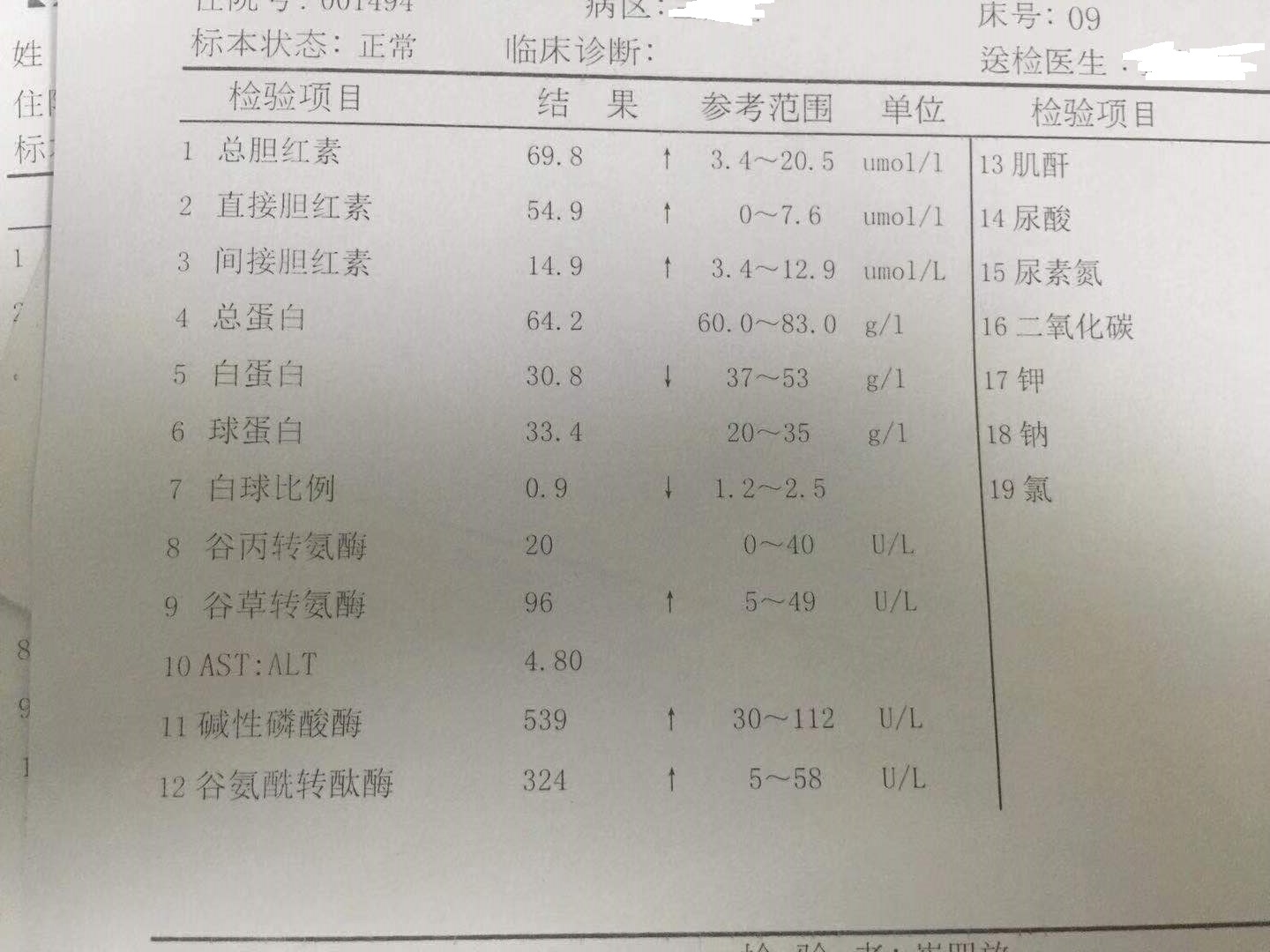 转氨酶过高会对身体造成什么影响？