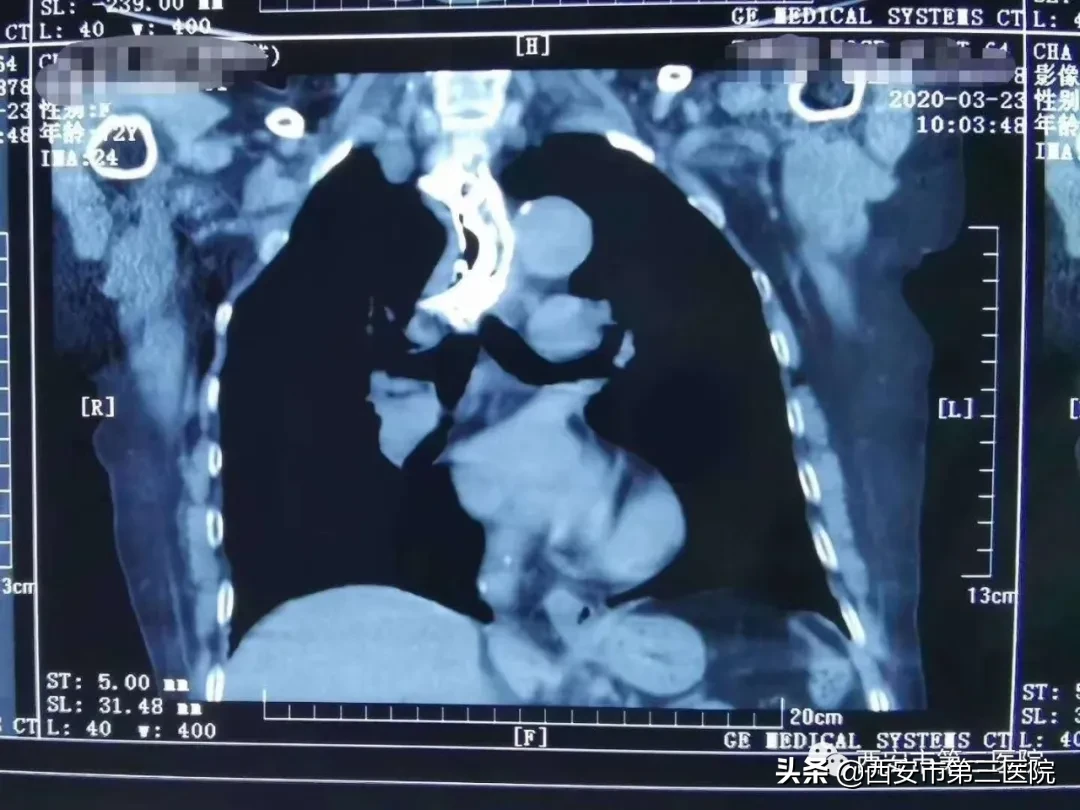 【四月回顾】西北大学附属医院•西安市第三医院动态“月”读