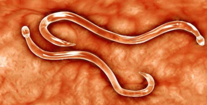 科学家以身试吃蛔虫卵,蛔虫为什么只能寄生在体内
